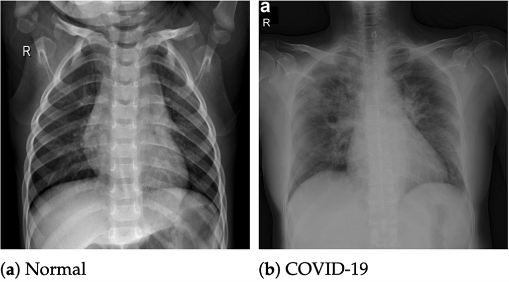 'Revolutionary' X-ray technology can diagnose COVID-19 in minutes
