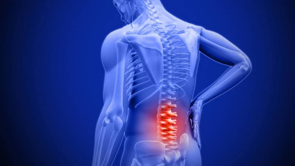 Crean un revolucionario dispositivo inflable que se inserta en la médula espinal para eliminar el dolor sin necesidad de cirugía
