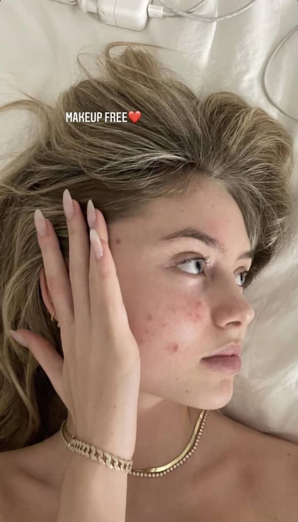 Leni Klum shows herself on her Instagram story without any filters or makeup.