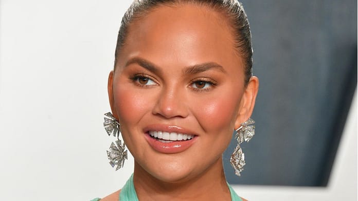 Chrissy Teigen: A new face thanks to plastic surgery

