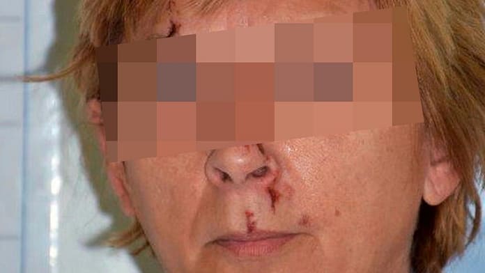 Croatian police solve the mystery of a woman with no memory

