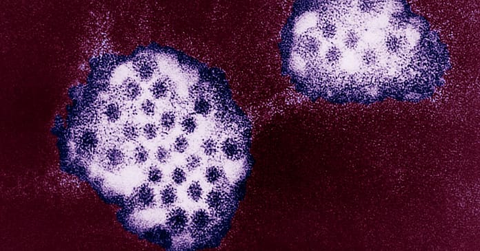 Gastrointestinal symptoms?  It may not be covid, but it could be norovirus.

