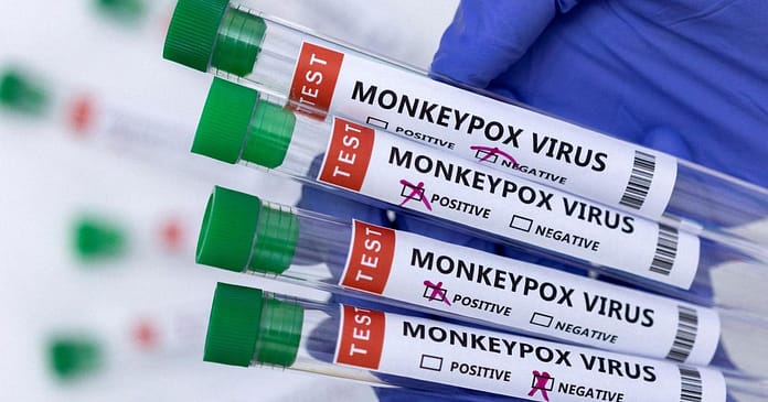 The first case of monkeypox was discovered in Brazil

