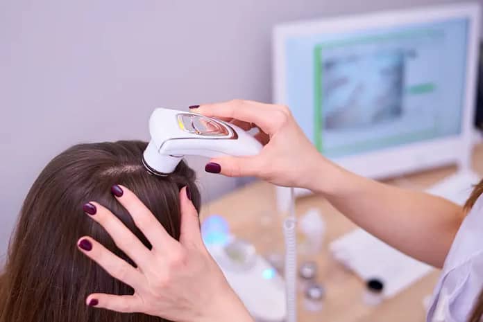 Examination of the scalp and hair follicles in case of hair loss with a modern device