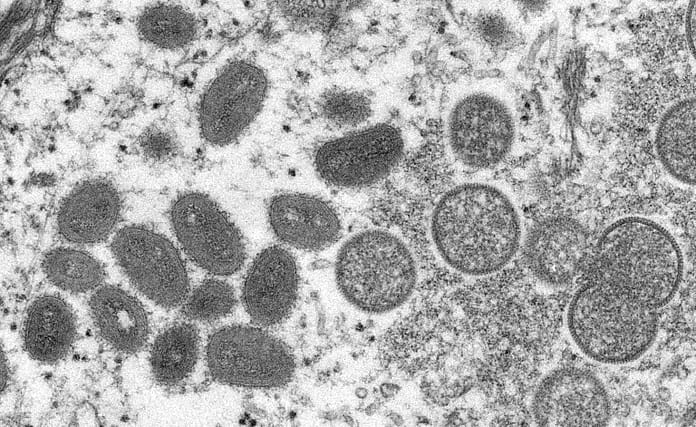 US expands monkeypox vaccination campaign - News Augsburg, Allgäu and Ulm

