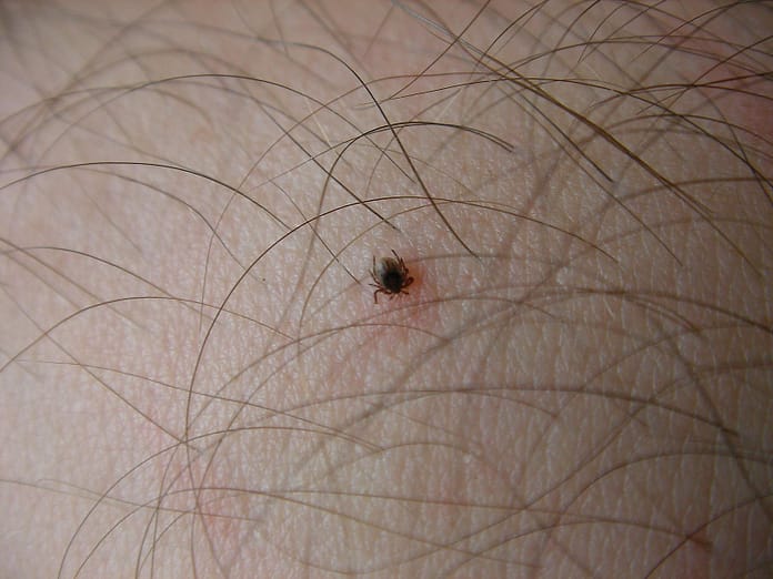 Lyme disease: Here are 5 places you may be at risk of tick bites

