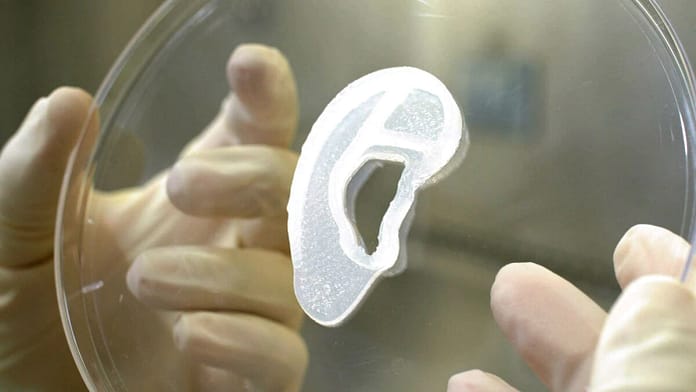 United States: A surgeon implants an ear implant printed from human cells

