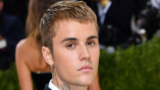 Ramsay Hunt syndrome diagnosed: Justin Bieber canceled concerts due to facial paralysis

