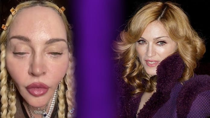 Madonna's TikTok video: Fans are shocked by the pop icon's face - people

