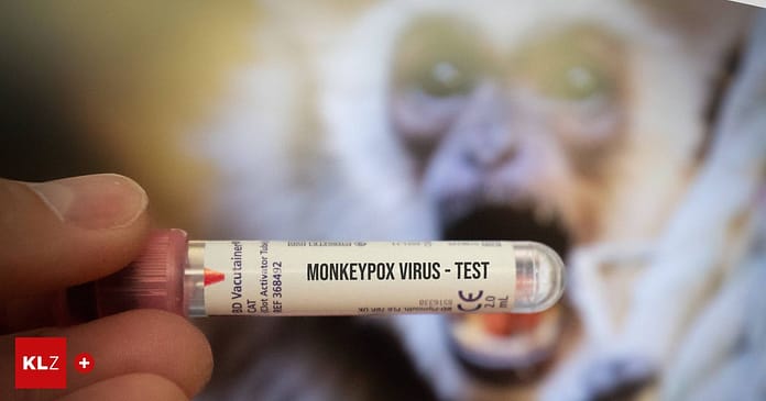 Viral disease: monkeypox: who belongs in the high-risk group and how to protect yourself

