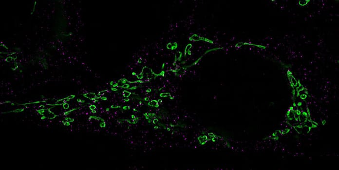 Mitochondrial fragmentation (green): Drp-1 proteins responsible for the decay are labeled with antibodies and stained purple.