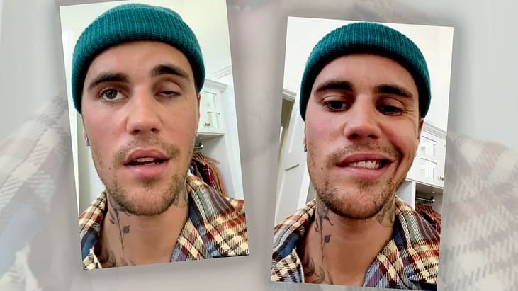 Justin Bieber publishes a shocking video: facial paralysis!